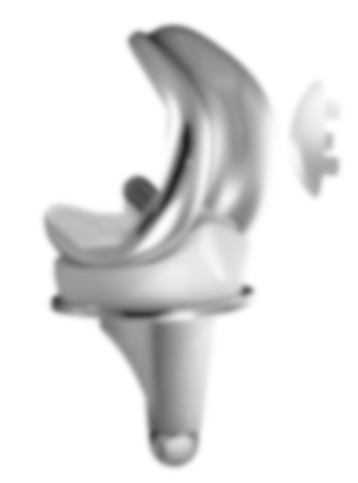 Knieprothese